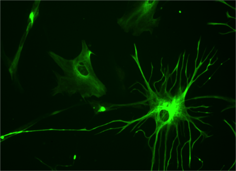A human astrocyte cell.