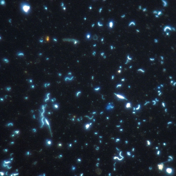 A DNA-binding-dye stained fluorescence micrograph of naturally occurring marine bacterioplankton.