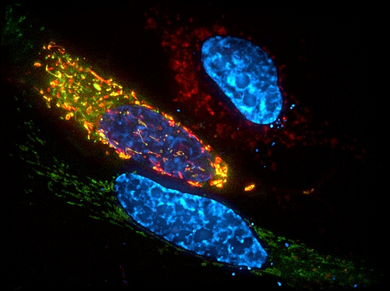 To determine the location of ALKBH7 in cells, MIT researchers engineered these cells to express ALKBH7 bound to green fluorescent protein (GFP). The cells’ mitochondria express a red fluorescent protein. In cells where ALKBH7 is present in the mitochondria, the green and red signals mix and appear yellow.