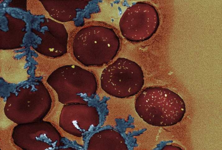 A colorized electron micrograph of red blood cells with gold nanorods (yellow dots) on their surfaces. The blue represents a fixing polymer.