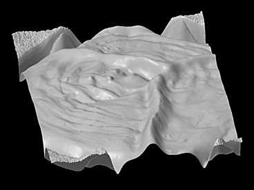 MIT researchers have developed a new type of endoscopy that can produce three-dimensional images of the surface of the colon.