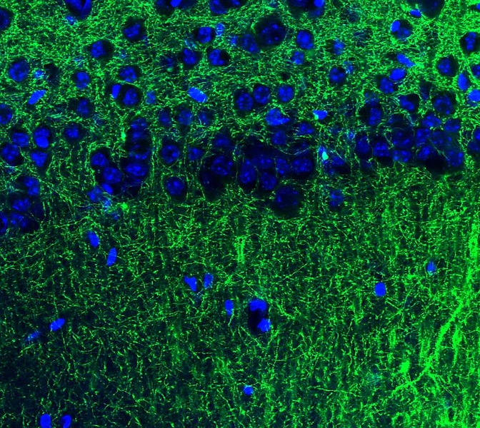 The tips of long neuronal extensions from the amygdala (green) contact neurons of the hippocampus (blue). This communication pathway helps to modulate anxiety.