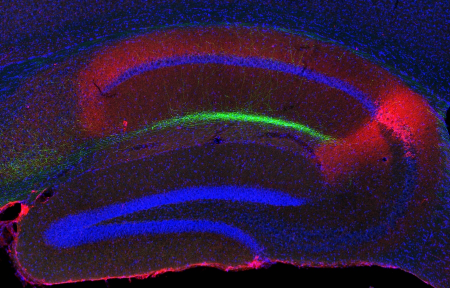 This cross-section of the hippocampus shows island cells (green) projecting to the CA1 region of the hippocampus.