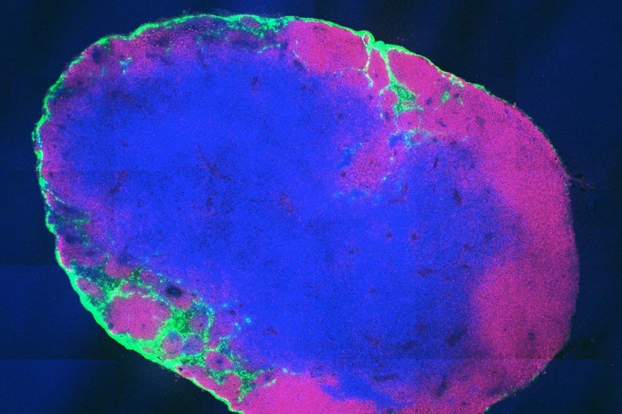 This cross section of a lymph node shows that the molecular
vaccine (green) has been taken up by immune cells in the lymph node.