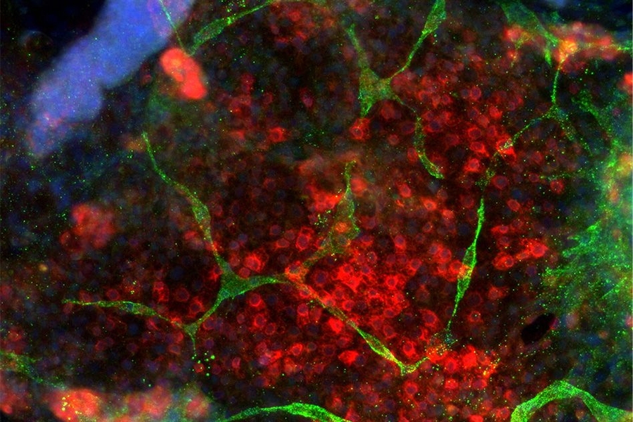 Liver cells and vasculature