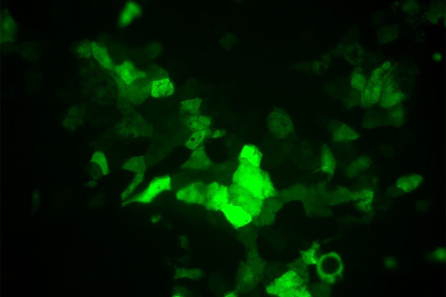 Developing liver cells as indicated by a tissue specific reporter