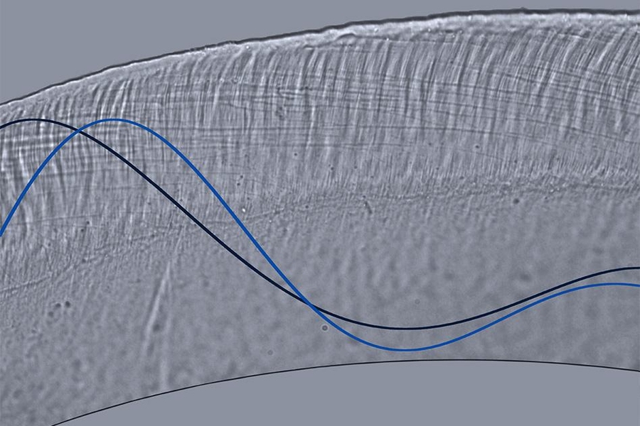 This optical microscope image depicts wave motion in a cross-section of the tectorial membrane, part of the inner ear. This membrane is a microscale gel, smaller in width than a single human hair, and it plays a key role in stimulating sensory receptors of the inner ear. Waves traveling on this membrane control our ability to separate sounds of varying pitch and intensity.