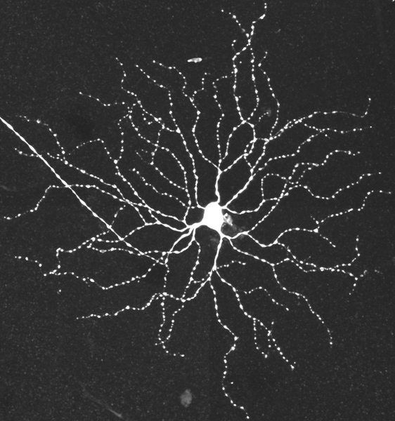 This image, taken with a light microscope, shows the body and many branching dendrites of a retinal ganglion cell.
