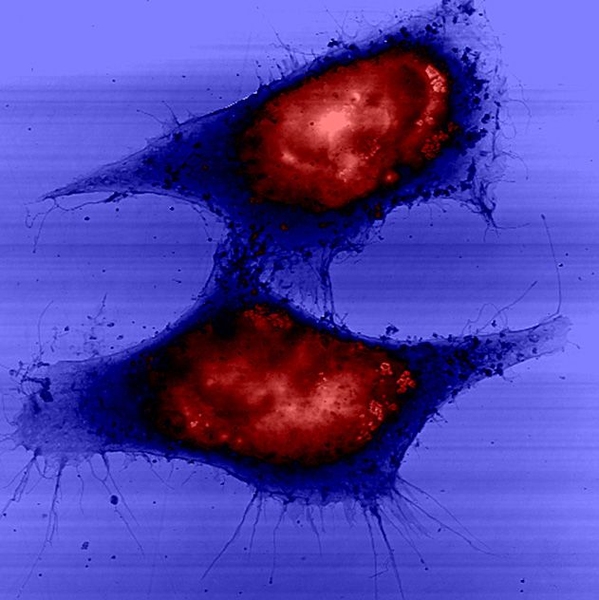 Health and Life Sciences: The human body, and human diseases like cancer, operate at the nanoscale. Robert Langer, the David H. Koch Institute Professor, works at that same scale, developing new drugs, devices, and diagnostics to fight cancer. Here, targeted cancer-fighting nanoparticles enter and change the cytoskeleton of a cancer cell. “I believe these new approaches have the power to transfo...