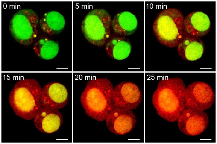 The particles were designed to release doxorubicin when exposed to ultraviolet light. Here, ovarian cancer cells turn red as the doxorubicin is released over time.