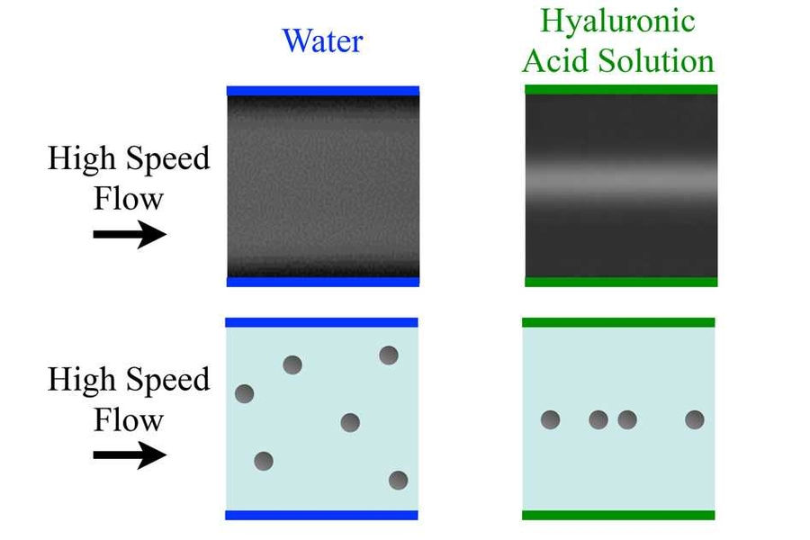 This image shows conventional long-exposure images (top row), and schematically depicted individual particle positions as revealed by the high-speed pulsed-laser imaging technique (bottom row) in a microfluidic device. At high speeds, the focusing effect on particles breaks down in water due to turbulence, whereas the focusing is preserved and enhanced by the team’s polymer solution.
