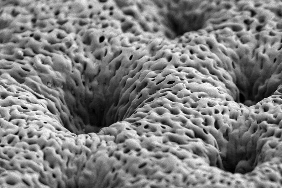Pictured is a scanning electron micrograph of a porous, nanostructured poly(lactic-co-glycolic acid) (PLGA) membrane. The membrane is coated with a polyelectrolyte (PEM) multilayer coating that releases growth factors to promote bone repair.
