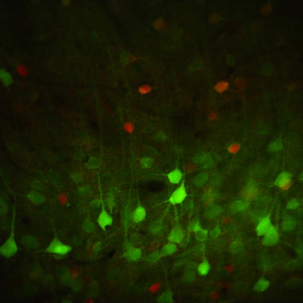 Neural activity in superficial visual cortex neurons.