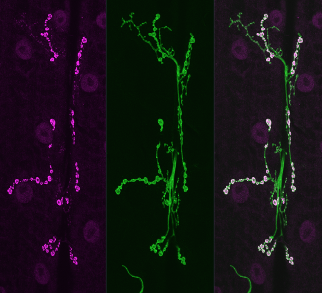Drosophila neuron.