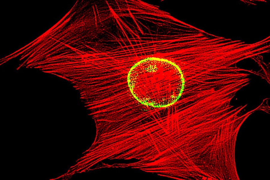mMIT and SMART researchers have developed a way to isolate mesenchymal stem cells based on physical traits such as stiffness.