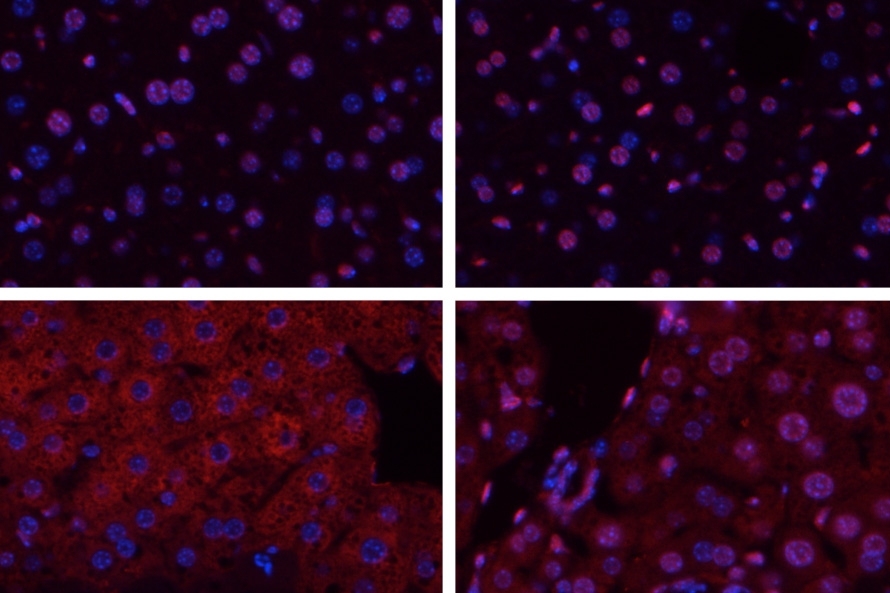 Aag deficient liver cells undergoing ischemia/reperfusion (bottom right) do not release as many inflammatory chemicals as normal cells (bottom left). The top row shows liver cells from mice that did not undergo ischemia/reperfusion.