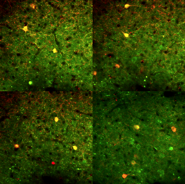 Neurons in the primary visual cortex of an awake mouse
