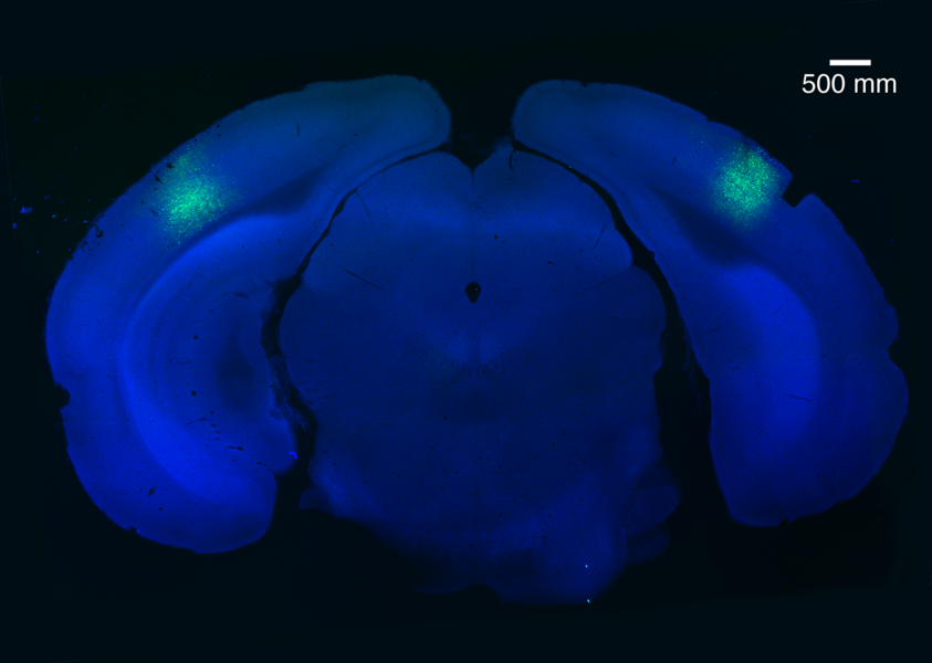 A small region of the brain called the primary visual cortex can be targeted using a virus (light green) to block habituation learning.