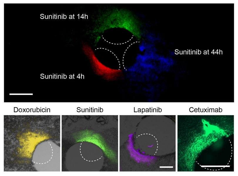At top, the researchers can use this device to measure how far a given drug spreads over time. At bottom, they used the device to measure the spread of four different cancer drugs.