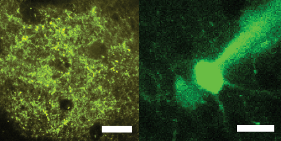 Neurons with markers that enable optical stimulation (left) and recording (right).