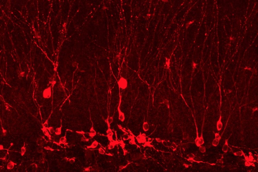 This image shows newborn cells in the hippocampus that were the result of the researchers' memory reactivation.