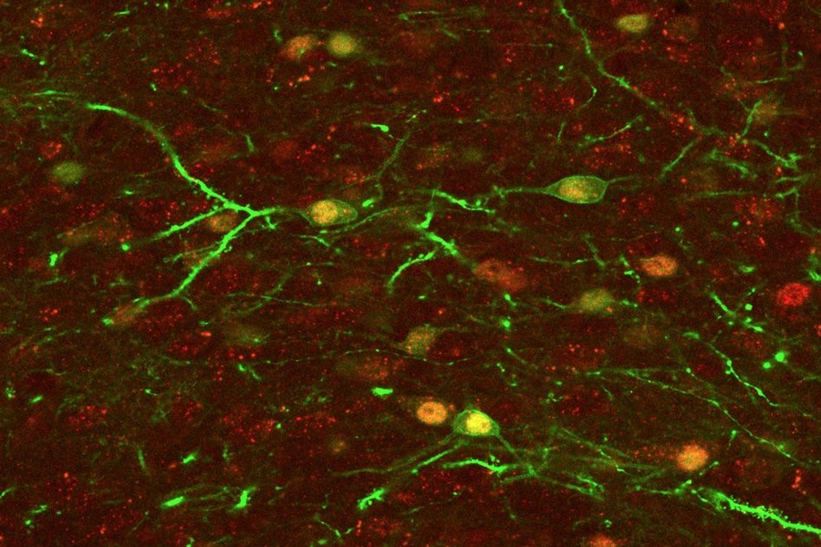 The nucleus accumbens, a key reward-related structure that lights up when a positive memory is reactivated in the hippocampus.