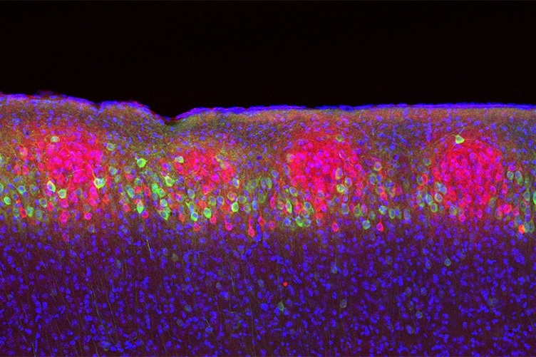 In this image of the entorhinal cortex, ocean cells are labeled with green fluorescence and island cells with red fluorescence. Blue fluorescence indicates the cell nuclei.