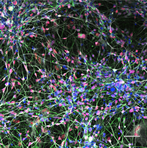 Human neurons express markers Map2 (gray), Nestin (green), and MeCP2 (red).
