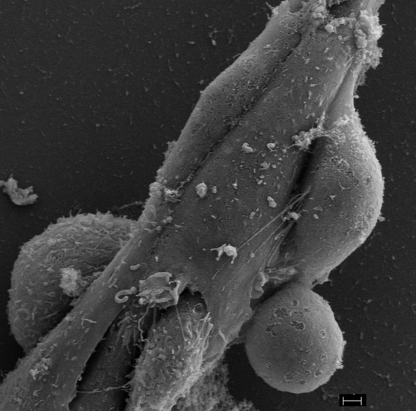 A cancer cell (bottom center) creates a gap and enters the endothelial tube. Another cancer cell (middle right) sends out nanotubes to connect with endothelial cells.
