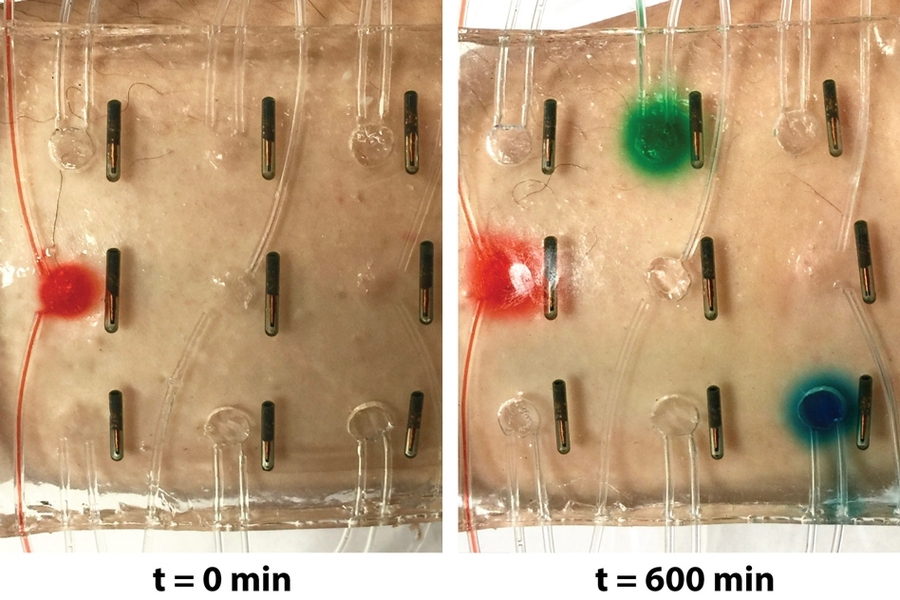 Stretchable Hydrogel Electronics | MIT News | Massachusetts Institute ...