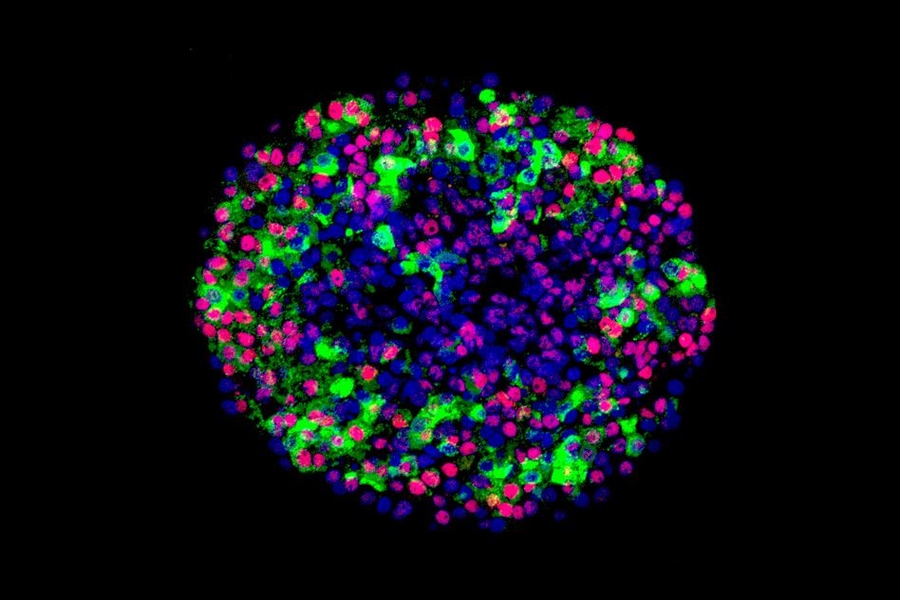 Glucose-stimulated insulin-producing cells derived from stem cells.