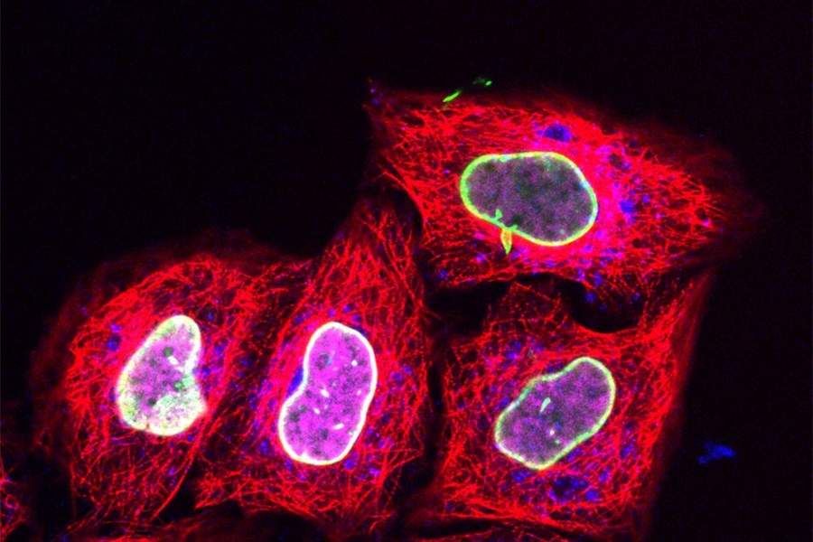 Cell squeezing enhances protein imaging | MIT News ...