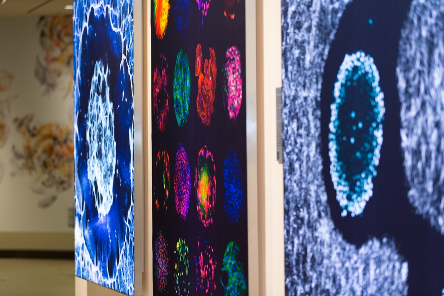 Wellcome Image “Stem Education” (left) hangs in the Koch Institute public galleries with “Suit Your Cell” (center) and “Sphere, There, and Everywhere” from MIT. Wellcome Images is a London-based world leader in the collection of biomedical imagery.