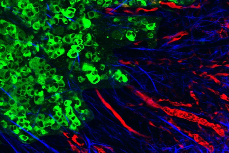 This image depicts the process of metastasis in a mouse tumor, where tumor cells (green) have helped to reorganize the collagen into aligned fibers (blue) that provide the structural support for motility. This helps the tumor cells to enter blood vessels (red), ultimately leading to the formation of metastases in other organs.