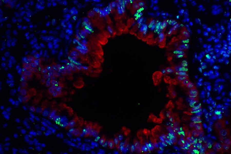 An image of epithelial cells surrounding a lung bronchiole in mice with asthma induced by dust mites. Researchers have shown that this type of asthma also produces DNA damage in lung cells, which is indicated in green.