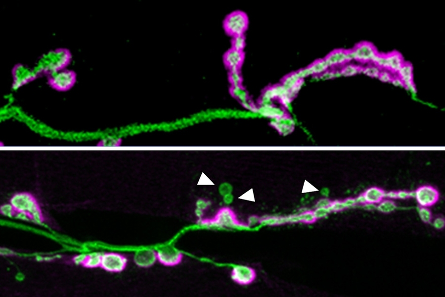 In the top image, a neuronal axon (green) forms many synapses, highlighted in purple. The bottom image shows an axon from a fruit fly lacking the Shank protein. In these flies, not as many synapses form, and some of them (indicated by the white arrows) do not fully mature.