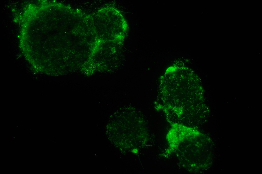 Fluorescence microscopy reveals the surface of a single synthetic particle colonized by wild marine microorganisms (green), which are fluorescently labeled with a double-stranded DNA stain.