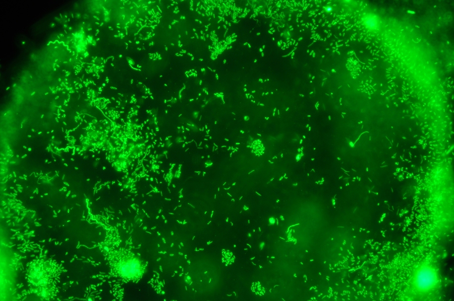 Fluorescence microscopy reveals the surface of a single synthetic particle colonized by wild marine microorganisms (green), which are fluorescently labeled with a double-stranded DNA stain.