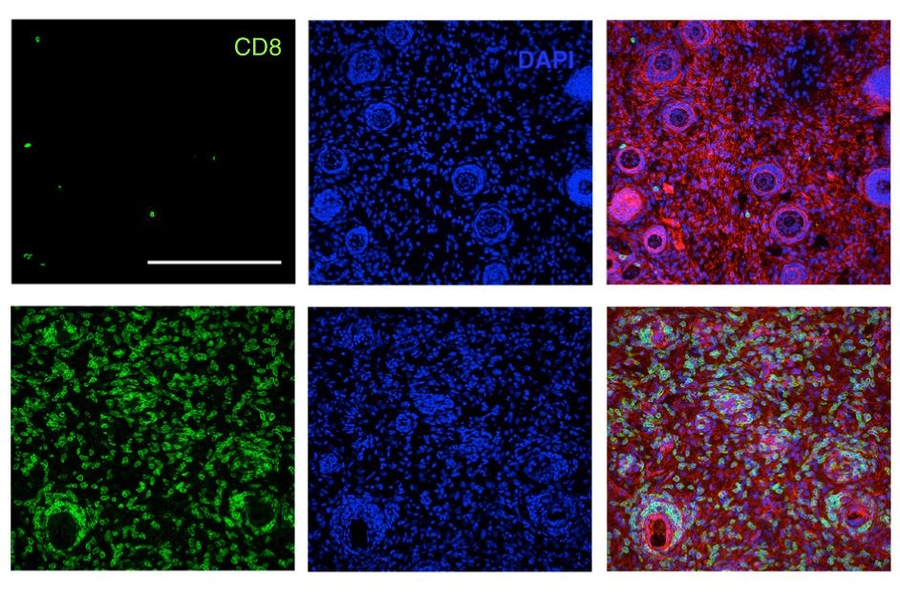 T cells — immune cells that are targeted to find and destroy a particular antigen — are key to the adaptive immune response. In this image, the top row shows few T cells in untreated mice, while the bottom rows show many T cells produced after immunotherapy treatment.