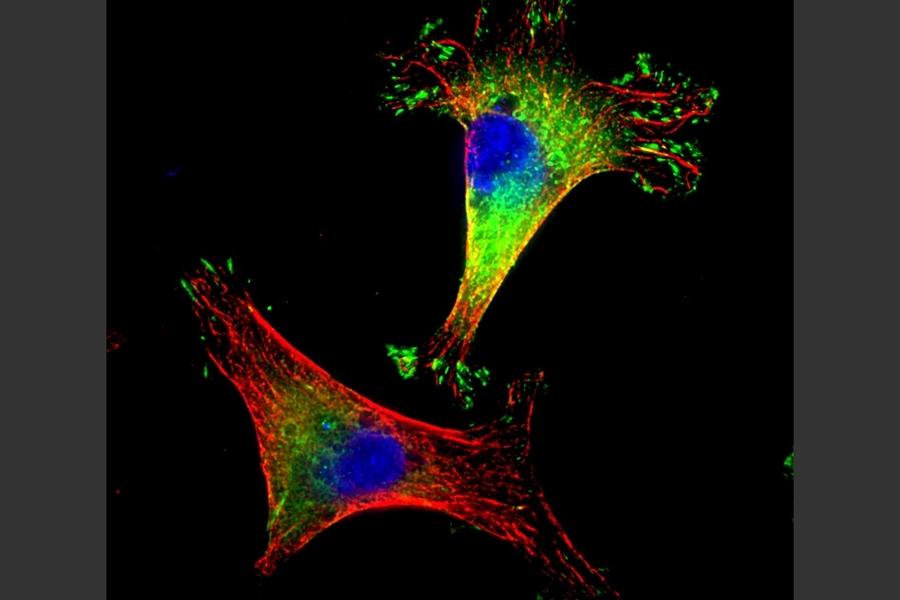 This image shows triple-negative breast cancer cells with the Mena invasive protein marked in green and the microtubules in red. 
