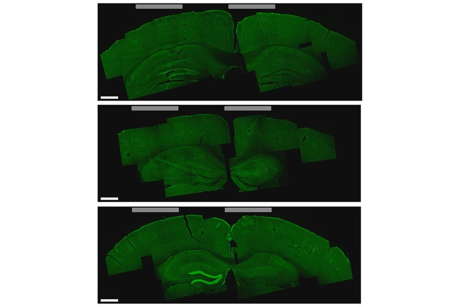A brain slice that shows the hippocampus cells that were activated by the new stimulation technique (bottom image, lighter green areas on the left)