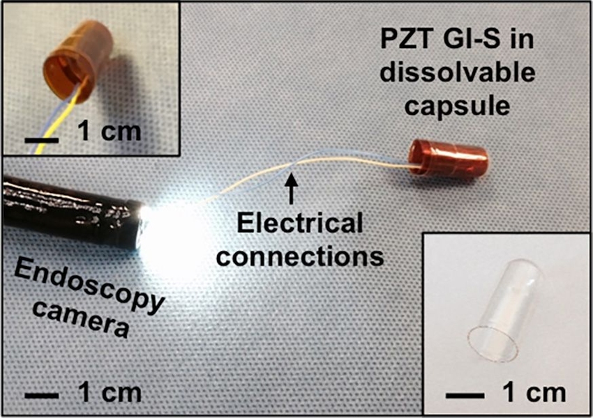This type of sensor could make it easier to diagnose digestive disorders that impair motility of the digestive tract, which can result in difficulty swallowing, nausea, gas, or constipation. 
