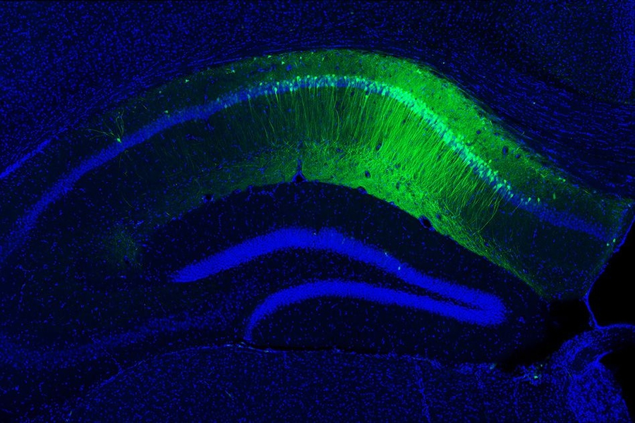The green staining shows hippocampal CA1 engram cells, which store a long-term fear memory and have the light sensitive optogenetic protein channelrhodopsin-2. The blue staining shows all cells in the dorsal hippocampus brain region, including non-engram cells (blue color staining only).
