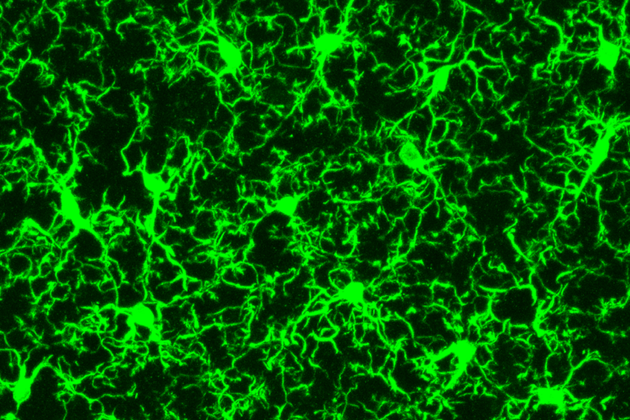 Microglia, the brain's immune cells, scavenge the brain for repairs and to remove potential infectious agents.