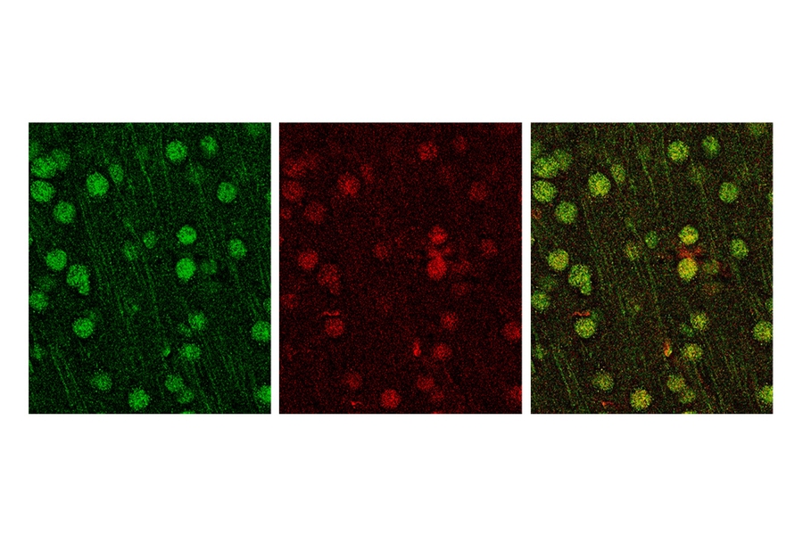 The MVP protein appears green in these stained neurons (red denotes neuronal marker SATB2).