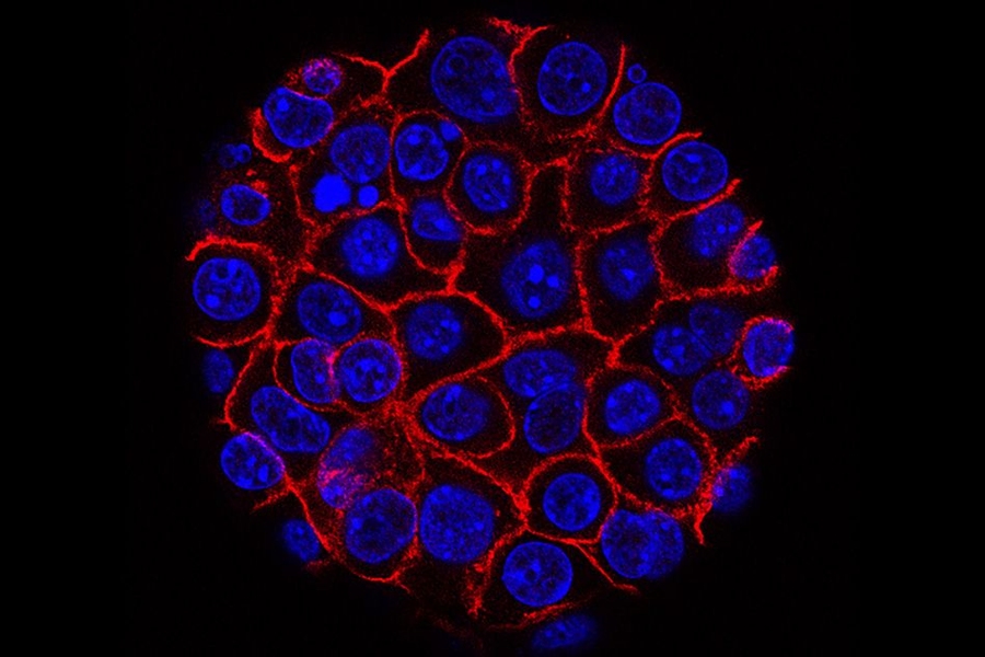 This image shows pancreatic cancer cells (nuclei in blue) growing as a sphere encased in membranes (red). 