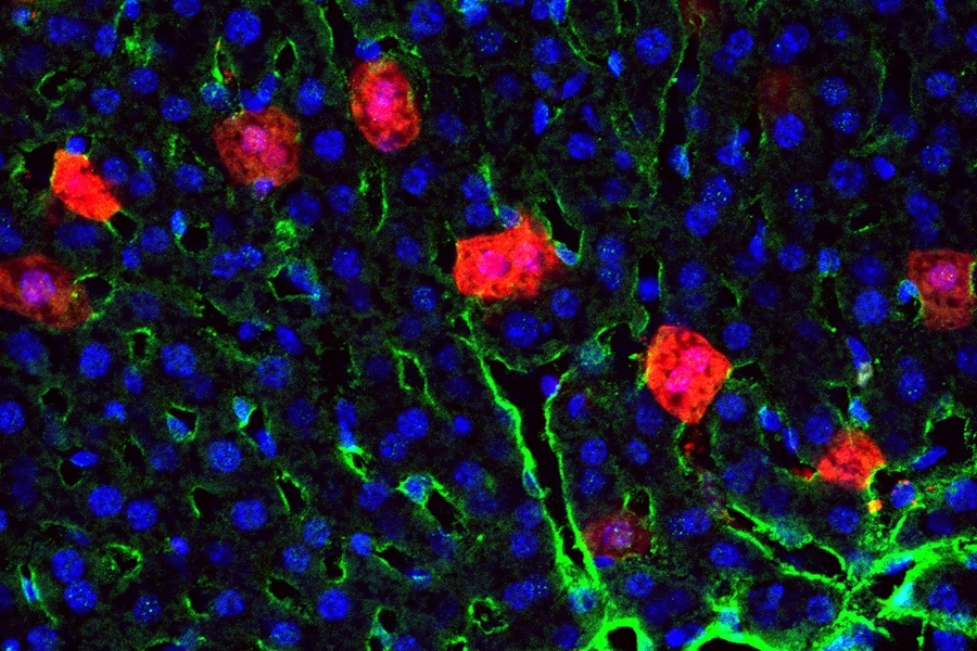 MIT researchers have designed nanoparticles that can deliver messenger RNA to specific organs, in this case, the liver. Cells expressing the synthetic mRNA show up as red.