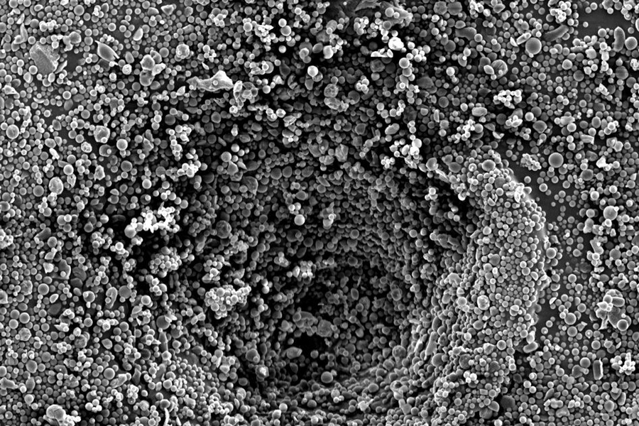 Researchers at MIT, BWH, and MGH have developed a strategy that enables point-of-care personalized therapy for glioma patients. Shown here is an electron microscopy image of the drug-delivery system developed by this team.
