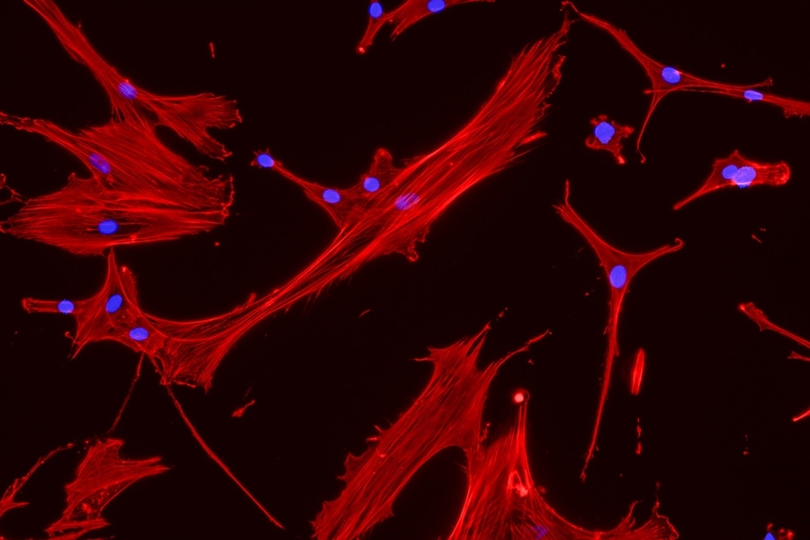 MIT engineers grew these mesenchymal stem cells (red, with blue nuclei) on a surface with mechanical properties similar to those of bone marrow.