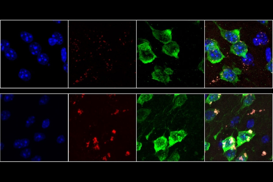 Neurons from 19-month-old mice (bottom row) show much higher rates of oxidative stress than neurons from 9-week-old mice (top row). Lipofuscin, a molecule associated with aging-related oxidative stress, appears red.